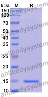 Recombinant Human CHFR Protein, N-His