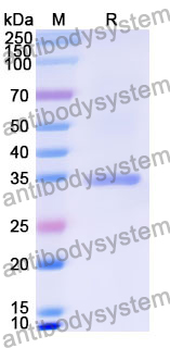 Recombinant Human C1GALT1C1 Protein, N-His