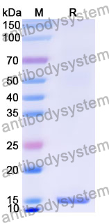 Recombinant Human MCRS1 Protein, N-His