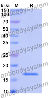 Recombinant Human TCTN2 Protein, N-His