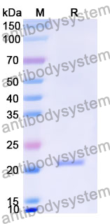 Recombinant Human COQ10A Protein, N-His
