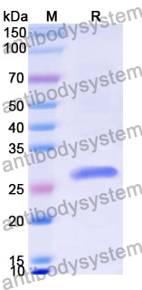 Recombinant Human SECISBP2 Protein, N-His