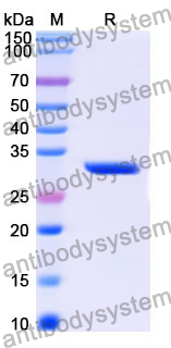Recombinant Human RMDN3 Protein, N-His