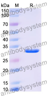 Recombinant Human EYA3 Protein, N-His