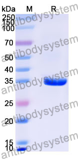 Recombinant Human PIK3R4 Protein, N-GST & C-His