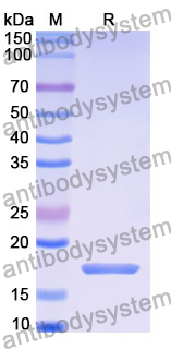 Recombinant Human CDCA3 Protein, N-His