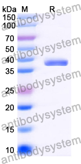 Recombinant Human PRMT1 Protein, N-His
