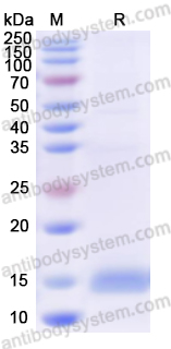 Recombinant Human FOXC2 Protein, N-His