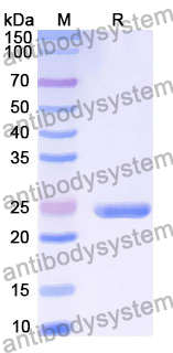 Recombinant Human ELAC2 Protein, N-His