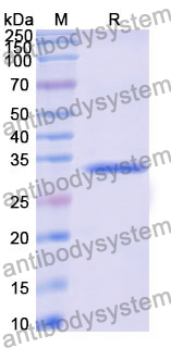 Recombinant Human SULT4A1 Protein, N-His