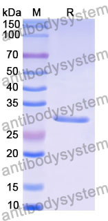 Recombinant Human WRAP53 Protein, N-His