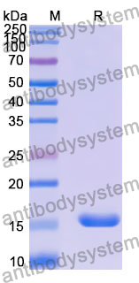 Recombinant Human COLEC11 Protein, N-His