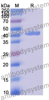 Recombinant Human MKNK2 Protein, N-His