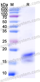 Recombinant Human SPACA1 Protein, N-His