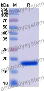 Recombinant Human SRA1 Protein, N-His