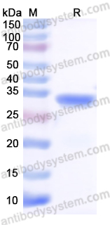Recombinant Human TIGAR Protein, N-His