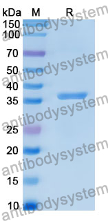 Recombinant Human PAK6 Protein, N-His