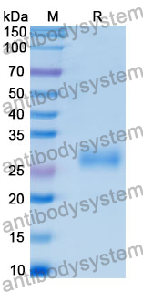 Recombinant Human PNPLA3 Protein, N-His