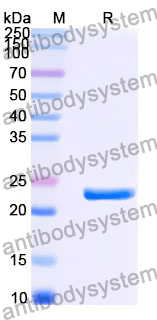 Recombinant Human INTS10 Protein, N-His
