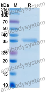 Recombinant Human RHBDL2 Protein, N-GST & C-His