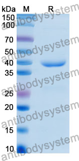 Recombinant Human RNF186 Protein, N-GST & C-His