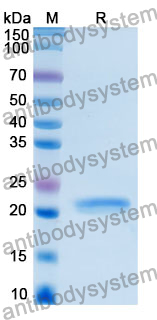 Recombinant Human DNAJB12 Protein, N-His-SUMO