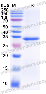 Recombinant Human OGFR Protein, N-His