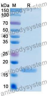 Recombinant Human UVRAG Protein, N-His