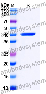 Recombinant Human SAE1 Protein, N-His