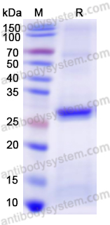 Recombinant Human PI4KB Protein, N-His