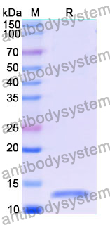 Recombinant Human DNAH17 Protein, N-His