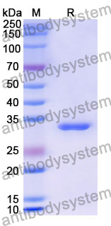 Recombinant Human CNOT7 Protein, N-His