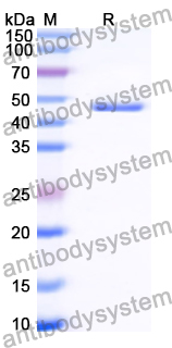 Recombinant Human NOCT Protein, N-His-SUMO