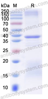 Recombinant Human FBXW2 Protein, N-His