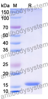 Recombinant Human CCPG1 Protein, N-His