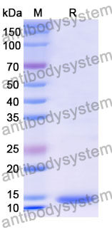 Recombinant Human NOB1 Protein, N-His