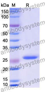 Recombinant Human RTRAF Protein, N-His-SUMO