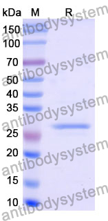 Recombinant Human DIS3 Protein, N-His