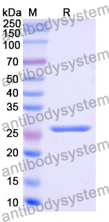 Recombinant Human COQ4 Protein, N-His