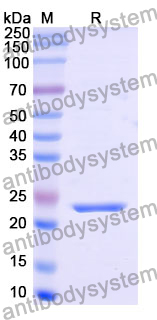 Recombinant Human SAR1B Protein, N-His