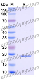 Recombinant Human CEPT1 Protein, N-His-SUMO