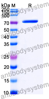 Recombinant Human UBA2/SAE2 Protein, N-His