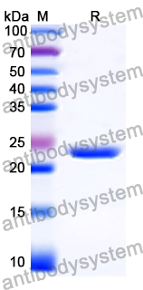 Recombinant Human SYNGAP1 Protein, N-His