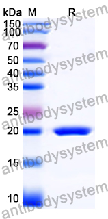 Recombinant Human KAT2B Protein, N-His