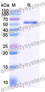 Recombinant Human OTUD1 Protein, N-His