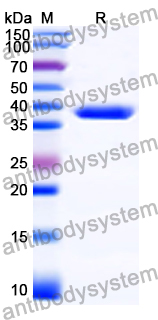Recombinant Human ASPM Protein, N-His