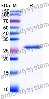 Recombinant Human ASPM Protein, N-His