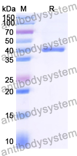 Recombinant Human SGK3 Protein, N-His