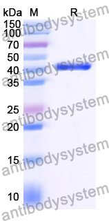 Recombinant Human KIAA0895L Protein, N-His