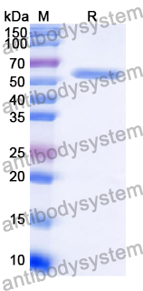 Recombinant Human PTPRQ Protein, N-His